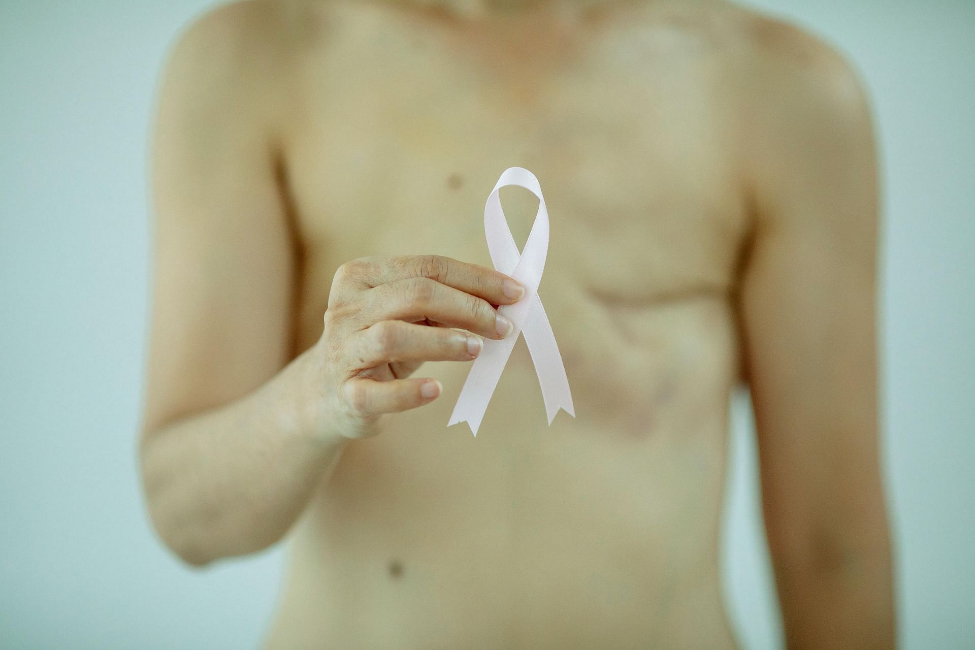 8 tips to reduce scars after surgery (image sourced via Pexels / Photo by michelle)